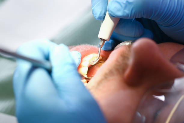 Best Emergency Dental Surgery in University Heights, IA